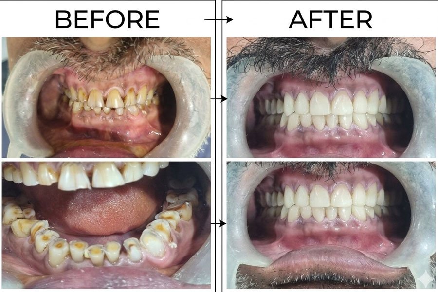 before after 6